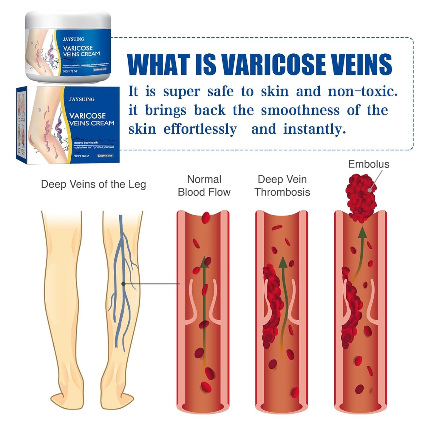 Varicose veins cream packaging with illustrations of varicose veins and normal blood flow.