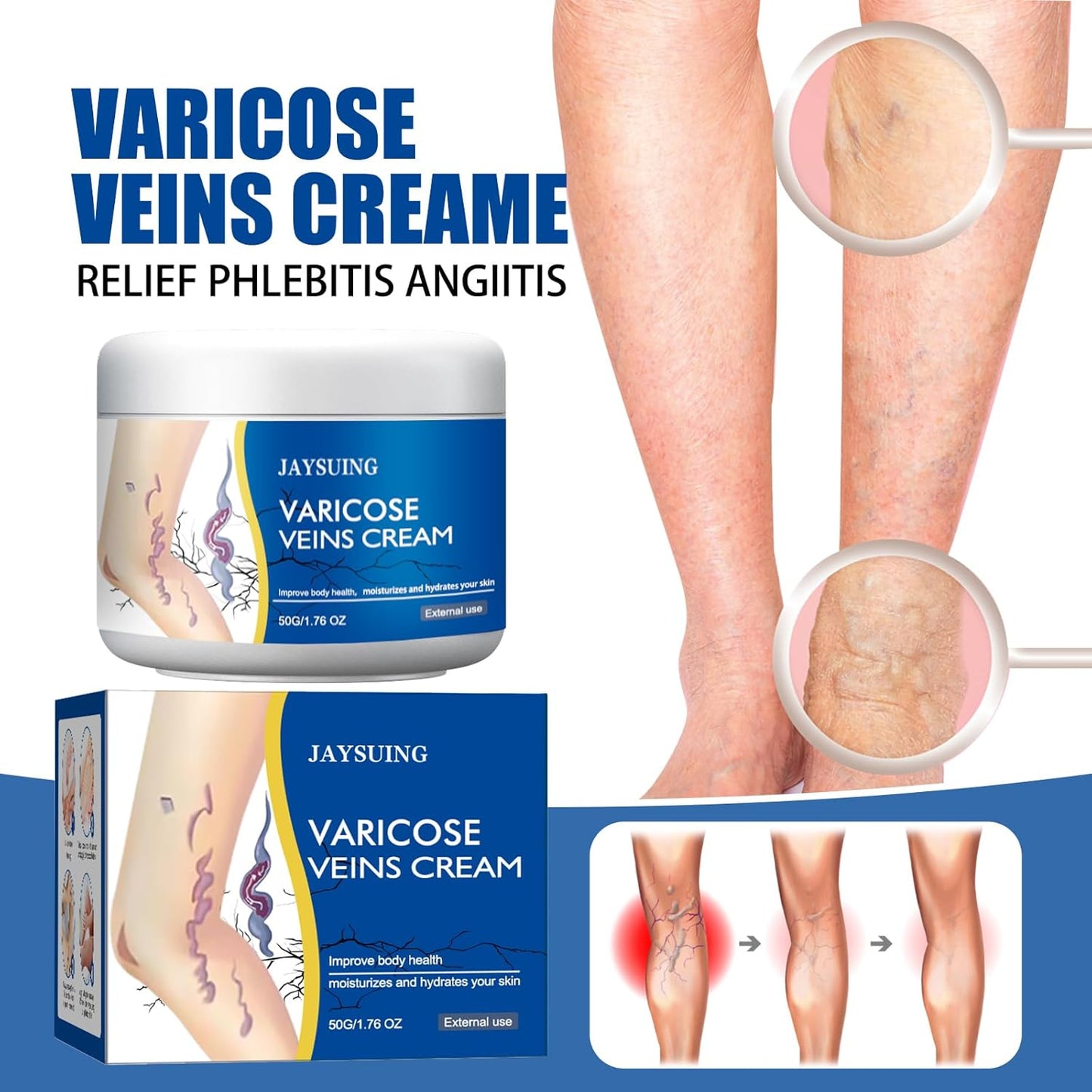 Jaysuing™ Varicose Vein Relief Cream