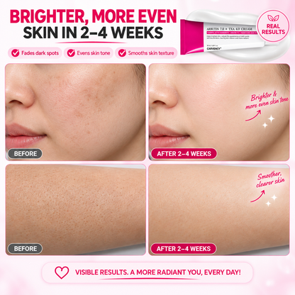 TOSOWO™ Arbutin 7% + Tranexamic Acid 4% Cream