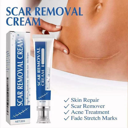 Professional Scar Removal Cream