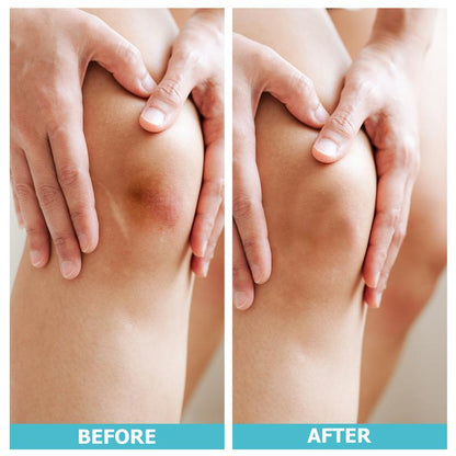 Mozy™ Hydrocolloid Roll – Professional Wound Care