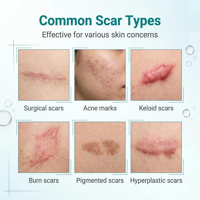Mozy™ Advanced Scar Repair Gel – 20g