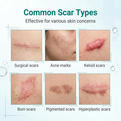 Mozy™ Advanced Scar Repair Gel – 20g