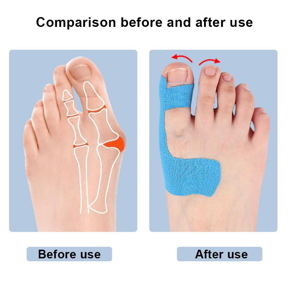 KinesioPro™ – Toe Pain Relief
