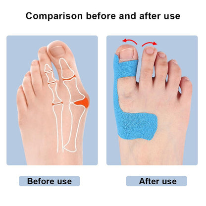 KinesioPro™ – Toe Pain Relief