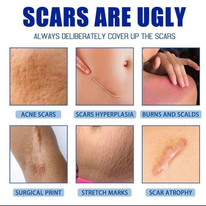 Professional Scar Removal Cream