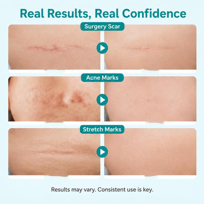 Mozy™ Advanced Scar Repair Gel – 20g