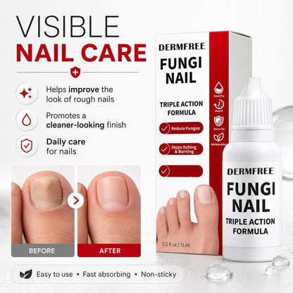 Mozy™ Triple Action Nail Care Serum
